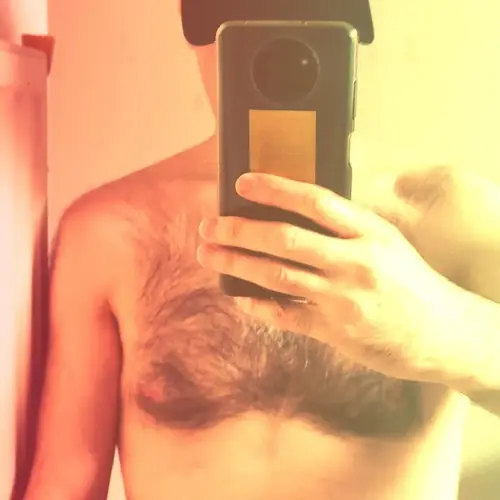 roaringkitty - hairy